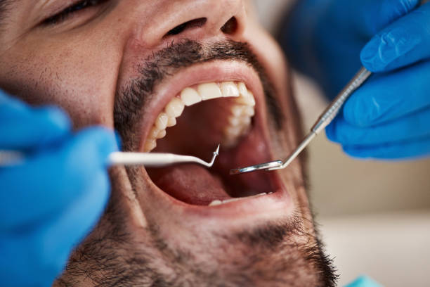 Best Sedation Dentistry  in Humboldt Hill, CA